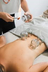 girl having cupping treatment at brassall massage ipswich